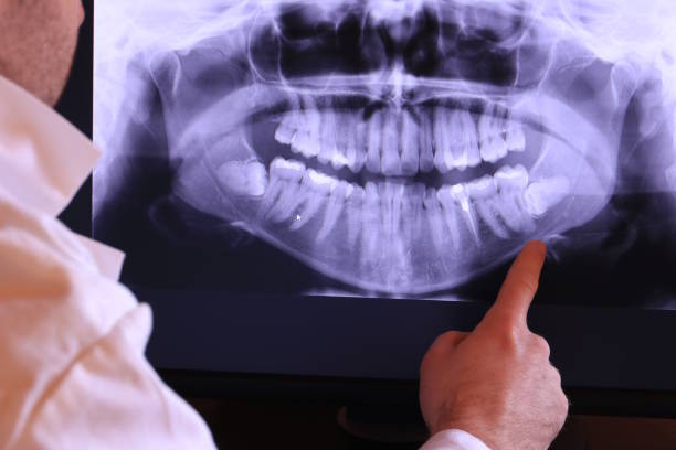Best Emergency Care for Gum Disease in Aust, IN