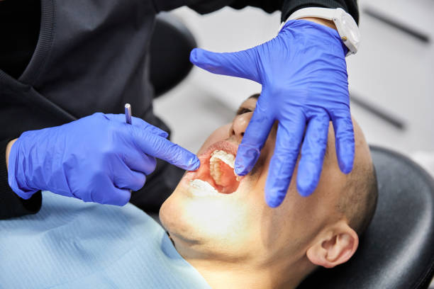 Best Knocked-Out Tooth (Avulsed Tooth) Treatment in Aust, IN